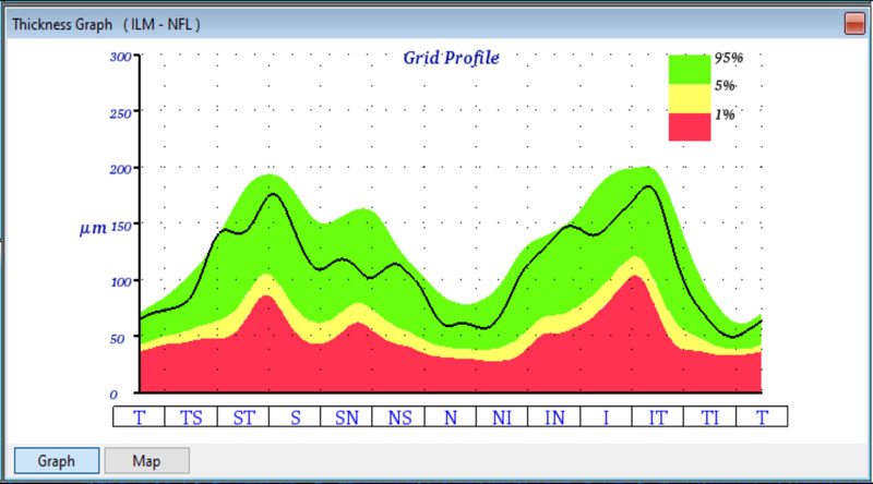 oct grid profile
